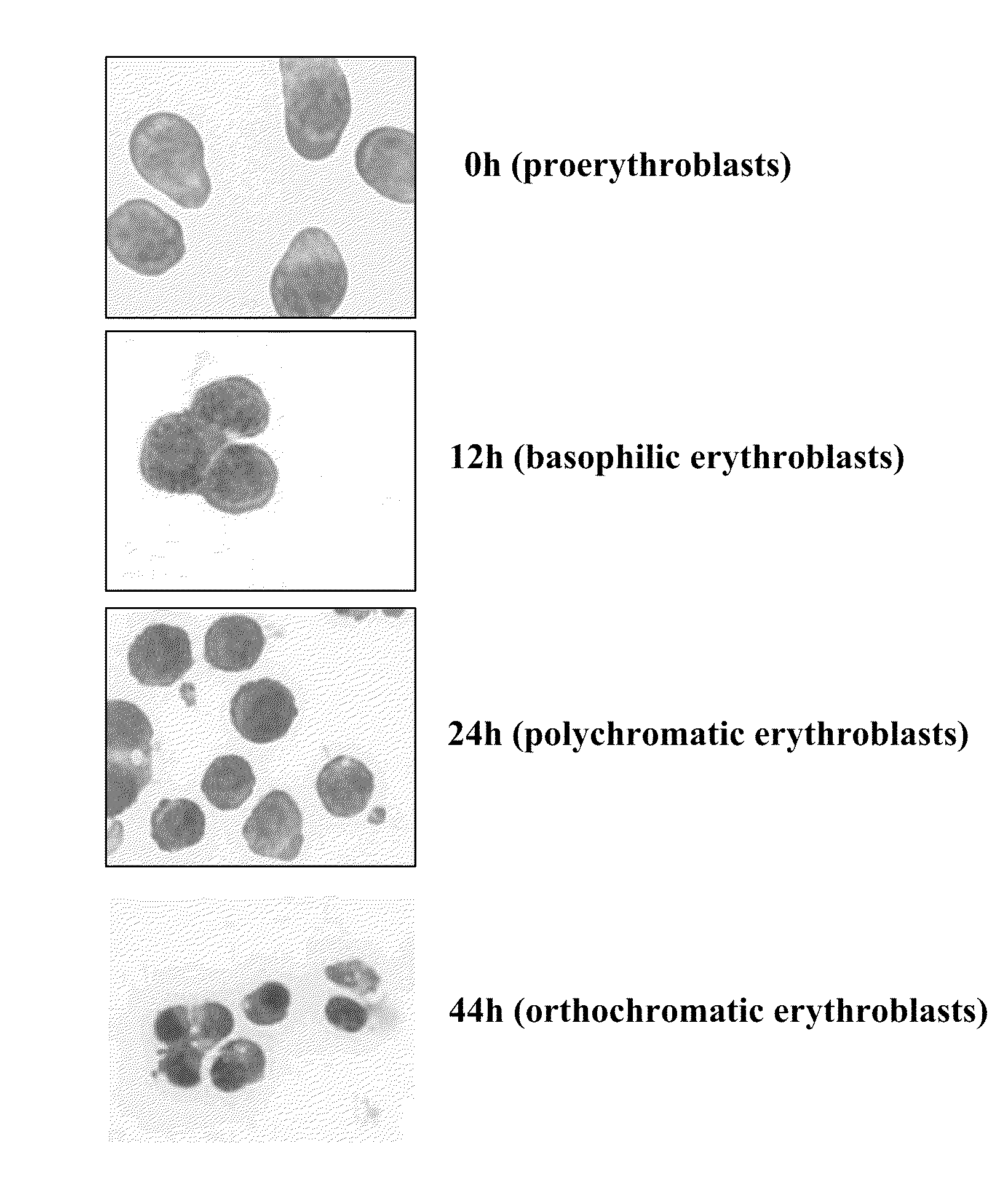 Ordered Assembly of Membrane Proteins During Differentiation of Erythroblasts