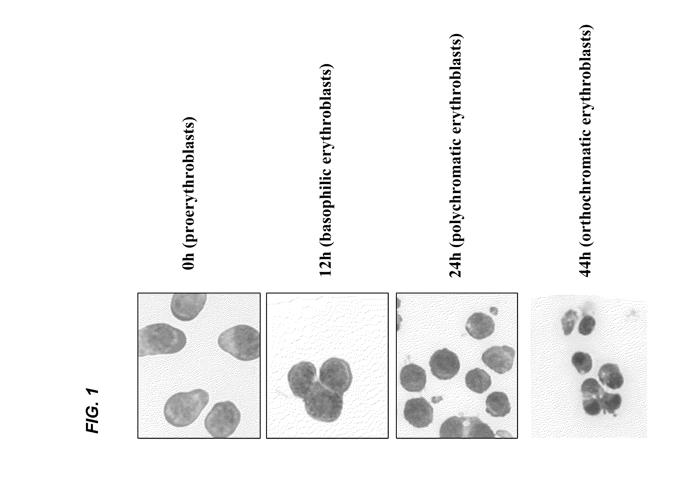 Ordered Assembly of Membrane Proteins During Differentiation of Erythroblasts