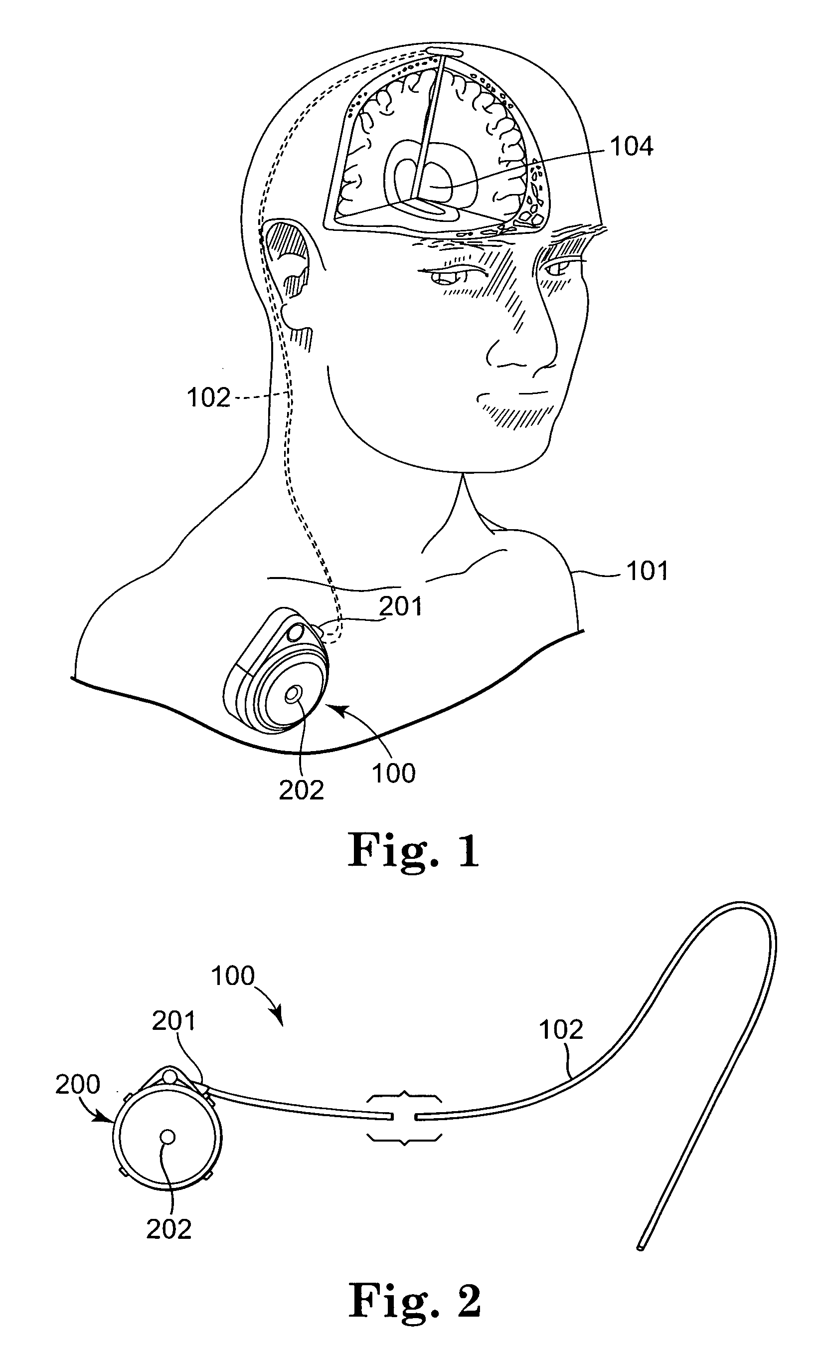Infusion device with positive pressure elastic bladder reservoir