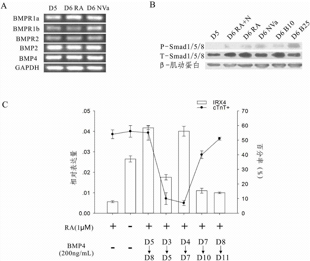 Method for differentiating as ventricular muscle cells by in-vitro induced pluripotent stem cells