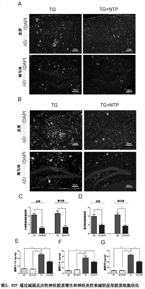 Inhibiting or alleviating agent for inflammation in the brain