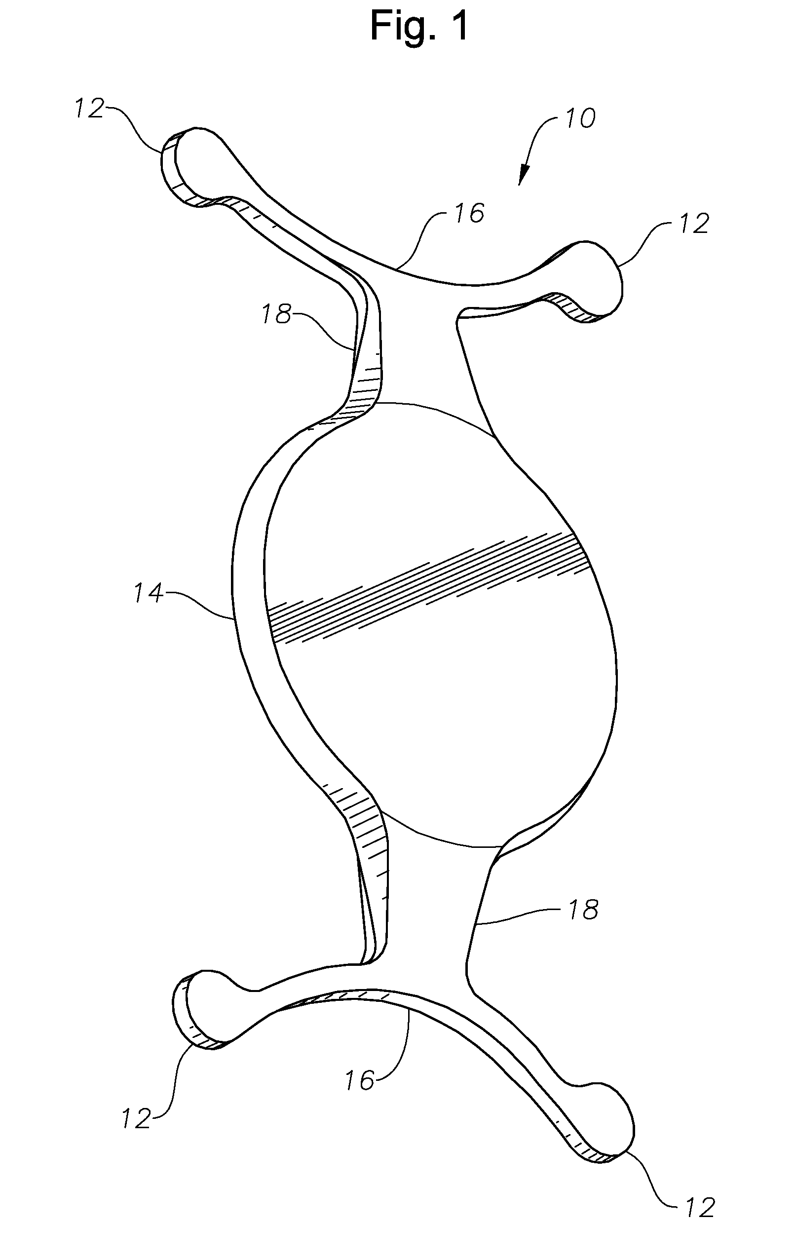 Stable anterior chamber phakic lenses