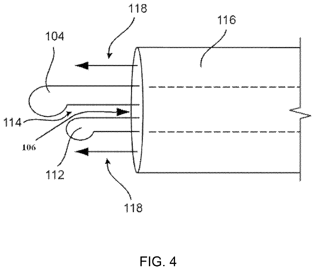 Cataract removal device and integrated tip