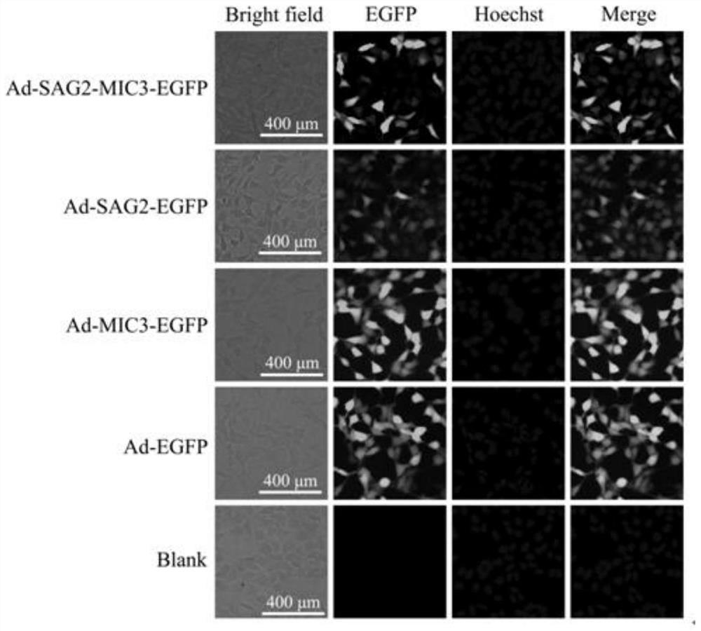 Toxoplasma gondii sag2 gene and mic3 gene recombinant adenovirus construction method, recombinant adenovirus and application