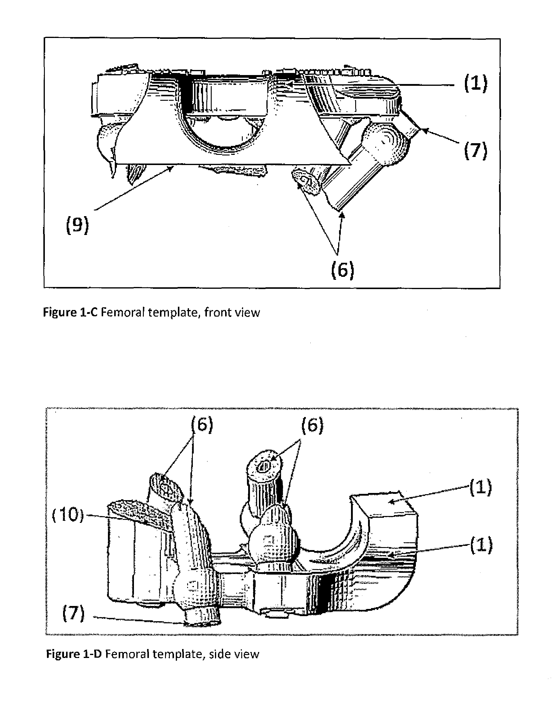 Device and method for fitting an artificial knee joint using universal electronic templates which can be adapted to all artificial joints