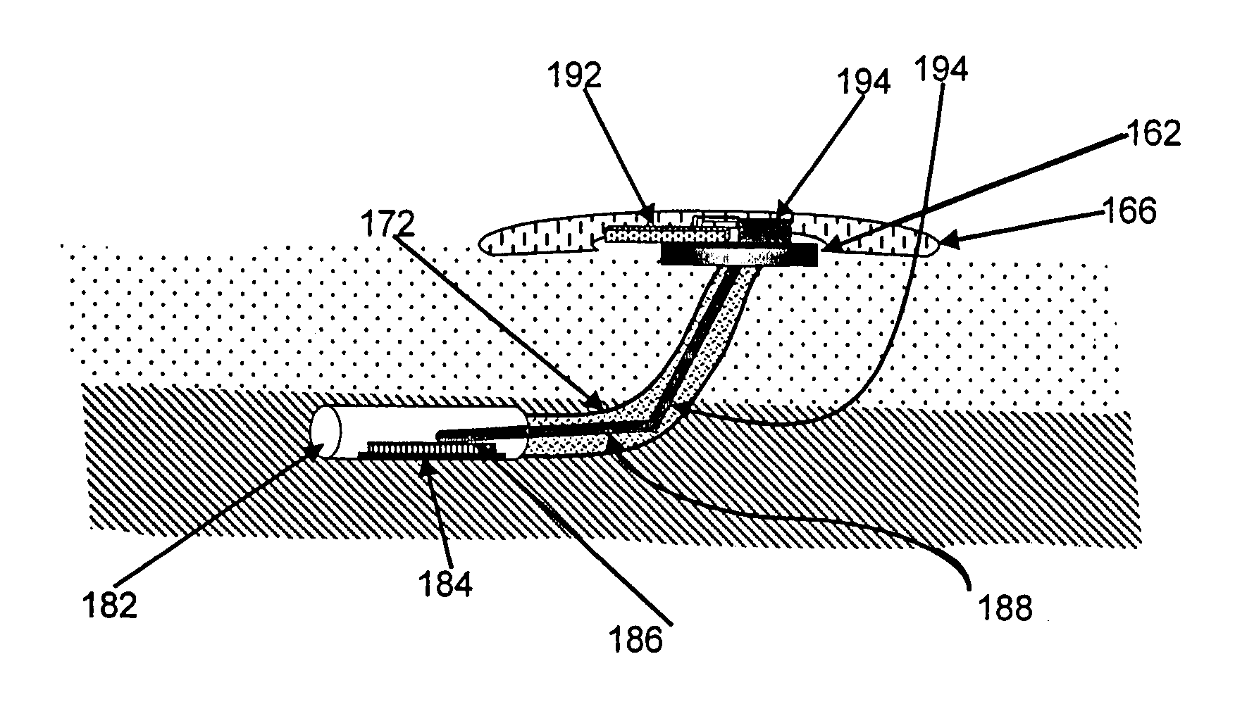 Gateway platform for biological monitoring and delivery of therapeutic compounds