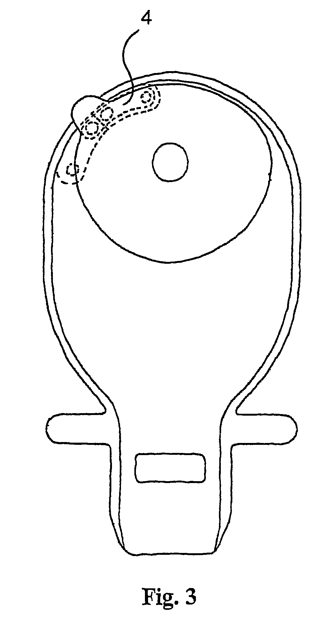 Ostomy appliance with multiple openings for preventing filter input blockage