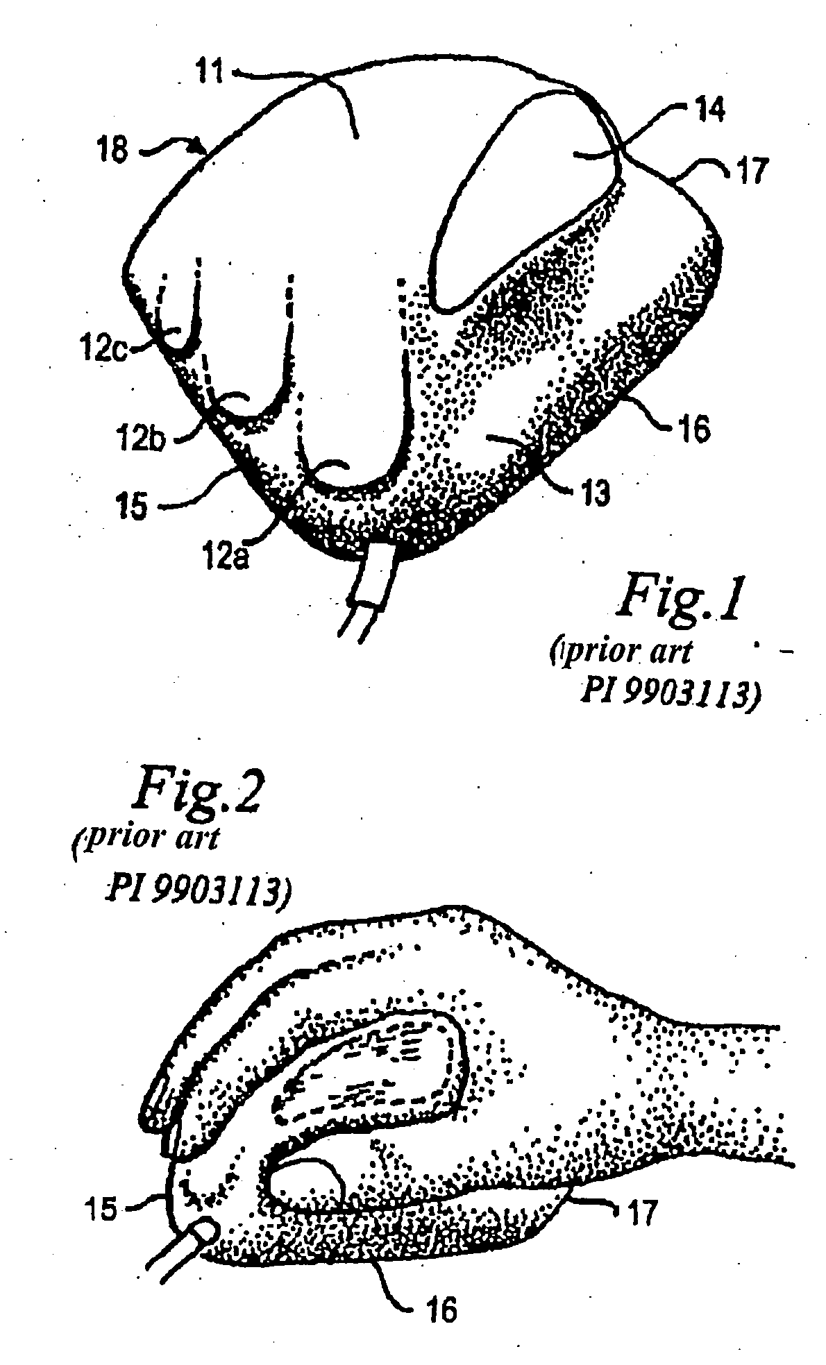Constructive Disposition Applied To The Orthopedic Computer Mouse