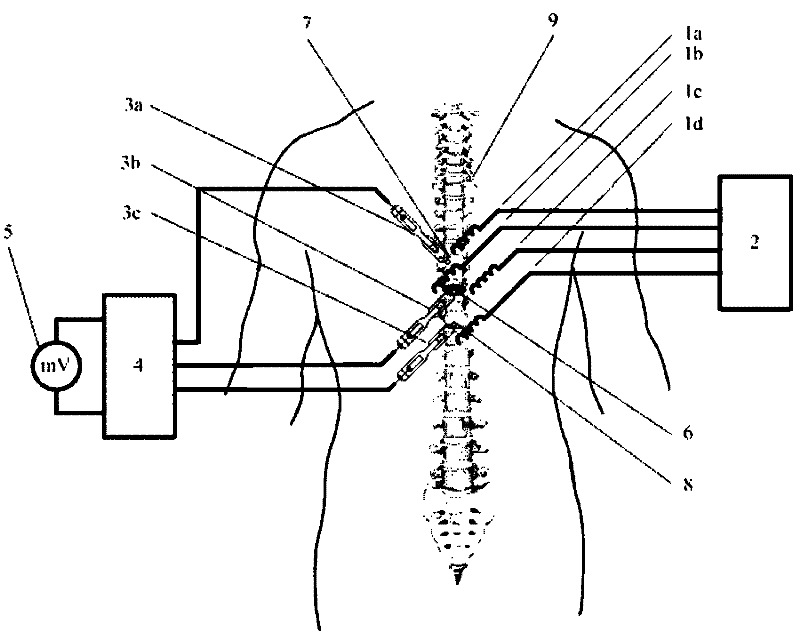 Method and device for injury potential compensation after spinal cord injury
