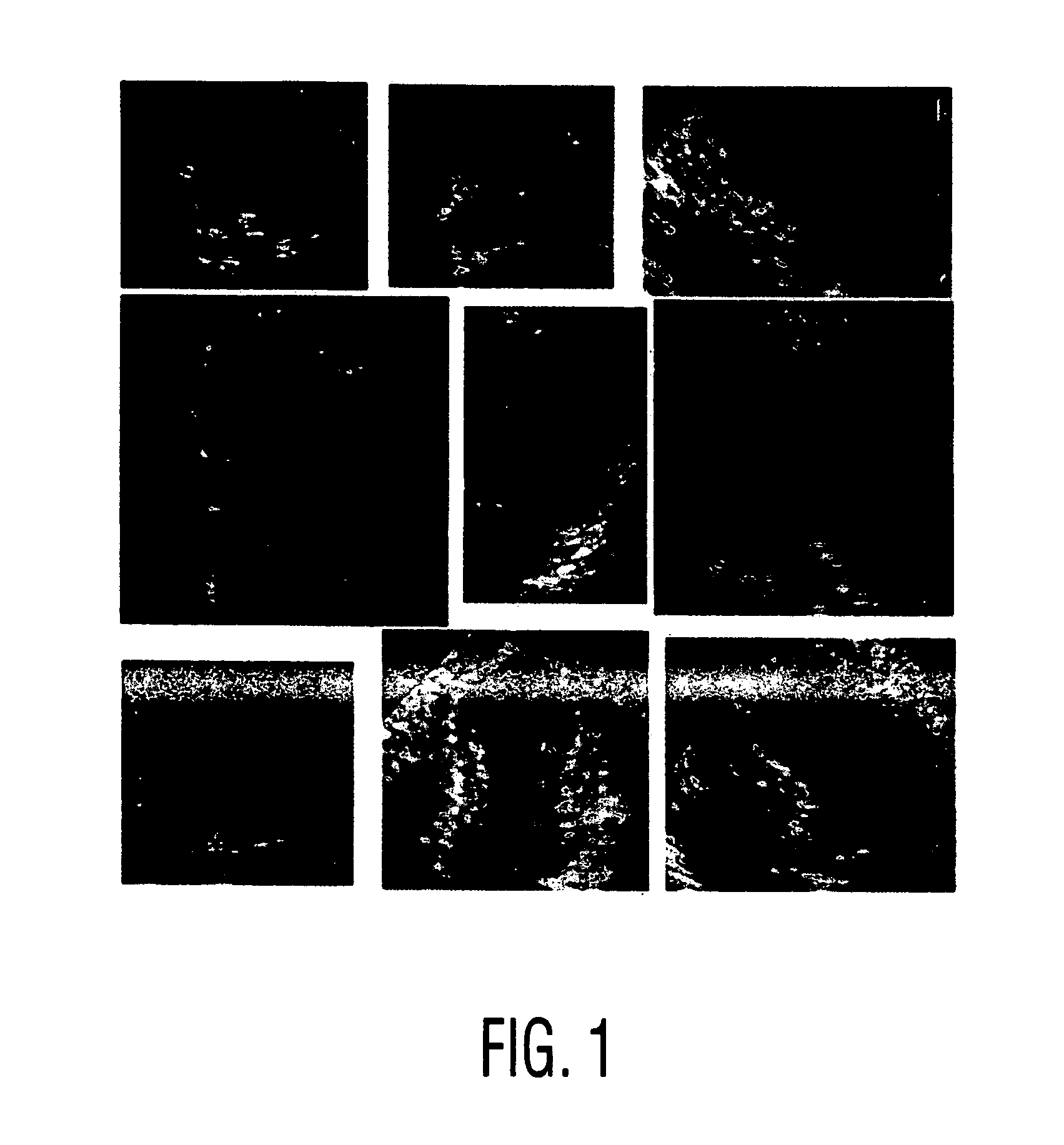 Method of database-guided segmentation of anatomical structures having complex appearances