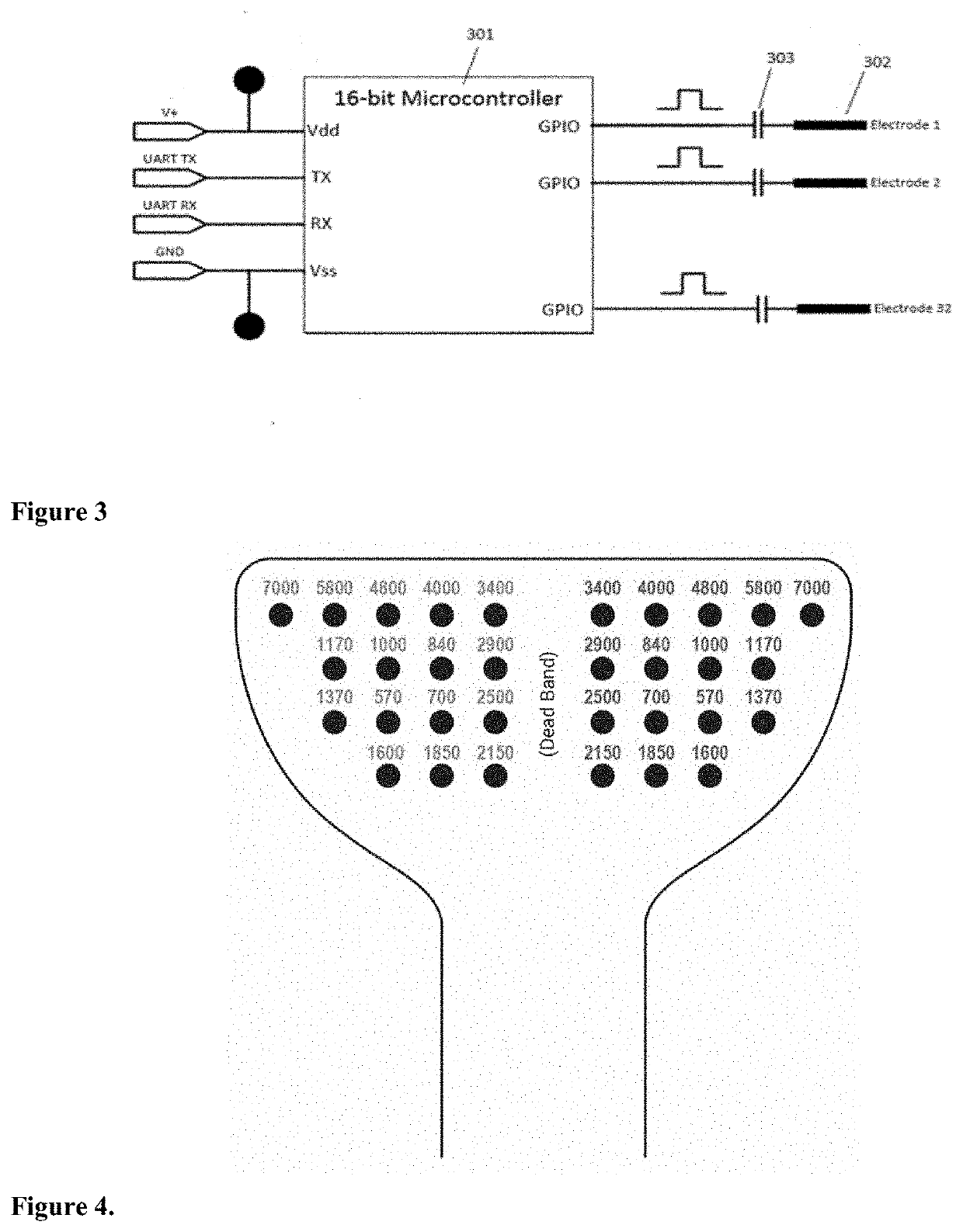 An apparatus and method for treating a neurological disorder of the auditory system