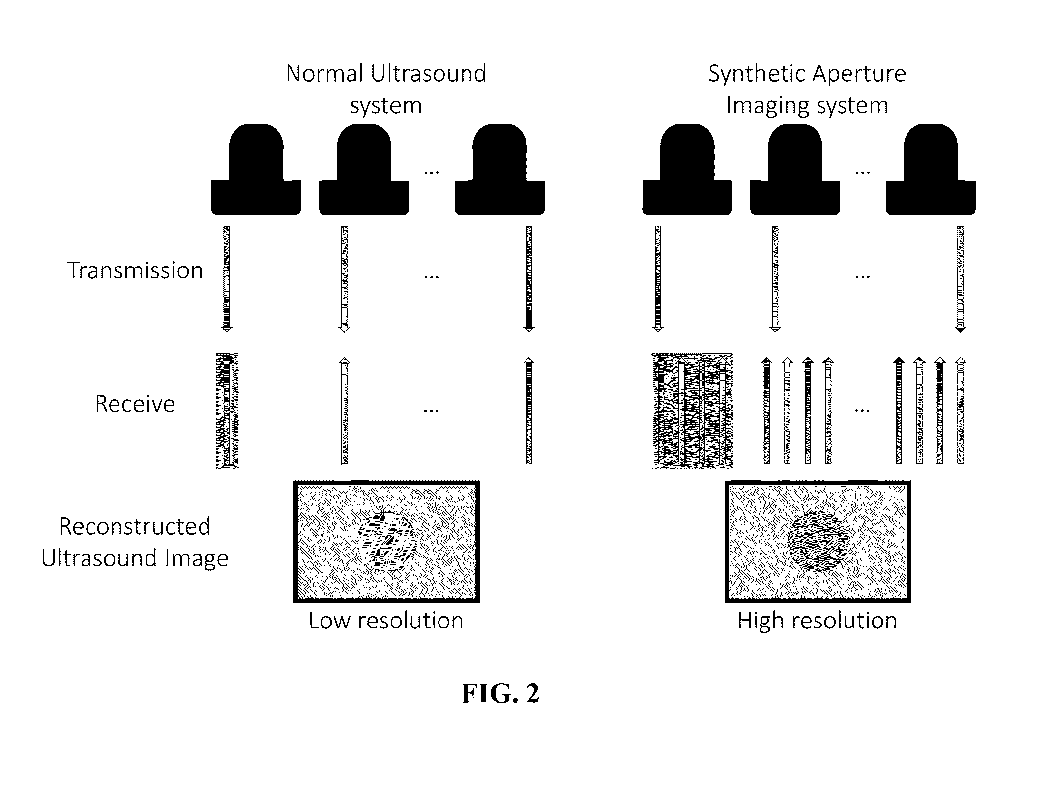 Synthetic aperture ultrasound system