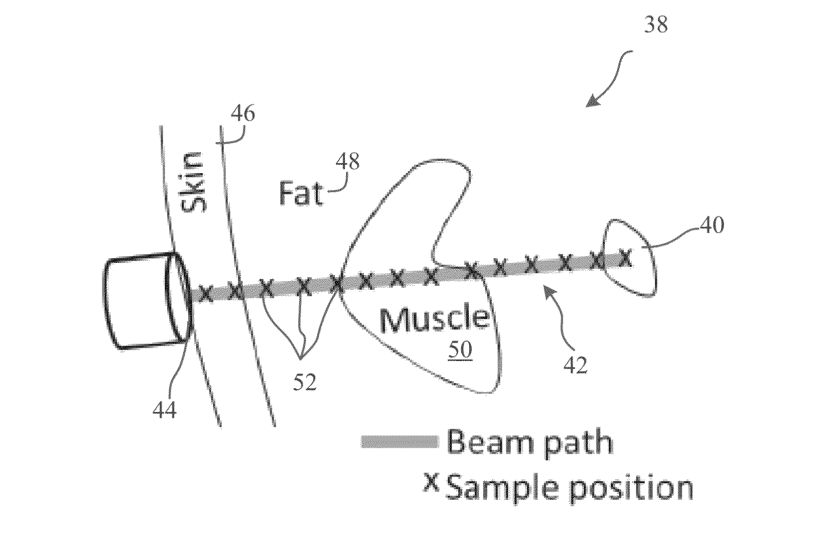 Apparatus and method for real-time tracking of tissue structures