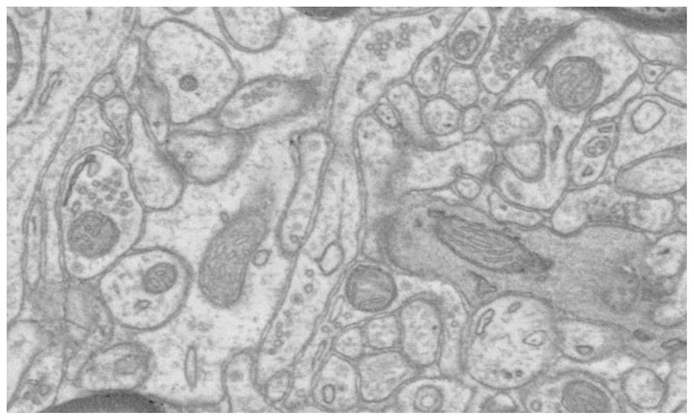 3D Image Library Acquisition Method Based on Sequential Etching and Thinning of Biological Tissue Slices