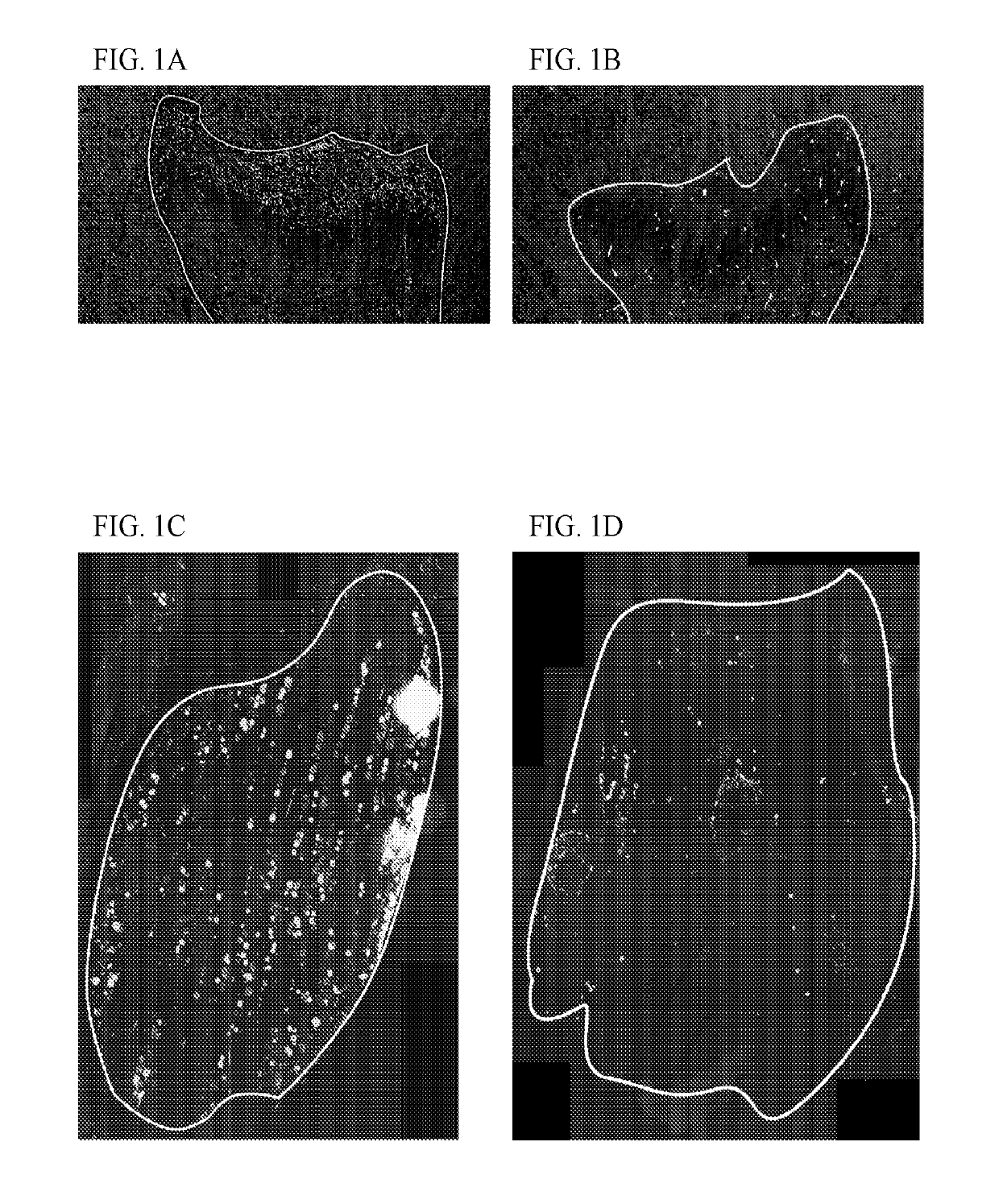 Materials and methods for treating regional pain