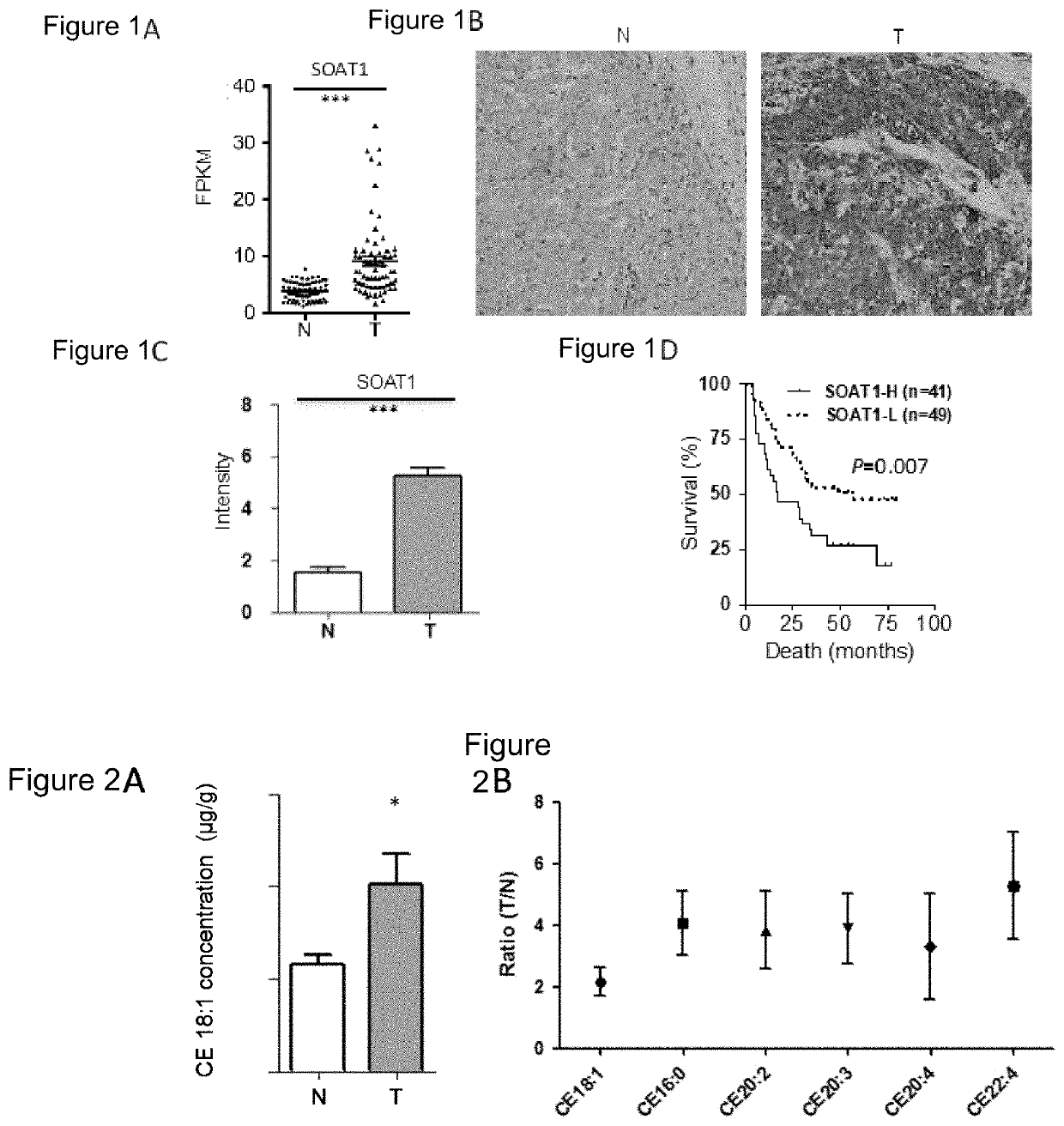 Use of acyl coenzyme a: cholesterol acyltransferase-1 in diagnosis and treatment of liver cancer