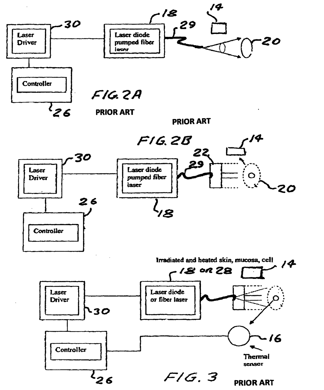 Method and device to investigate or treat painful neuropathy