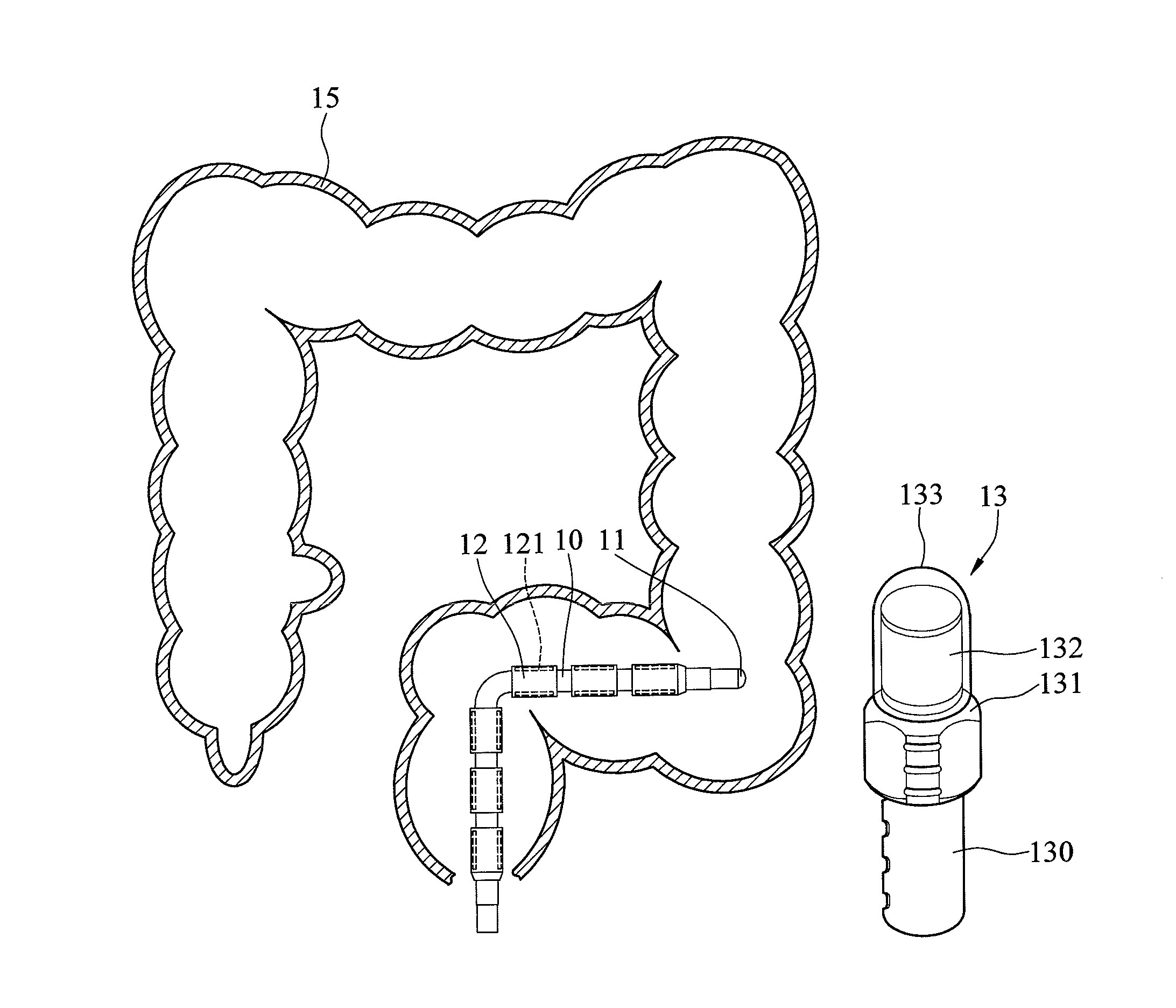 Magnetic-controlled system applicable for colonoscopy