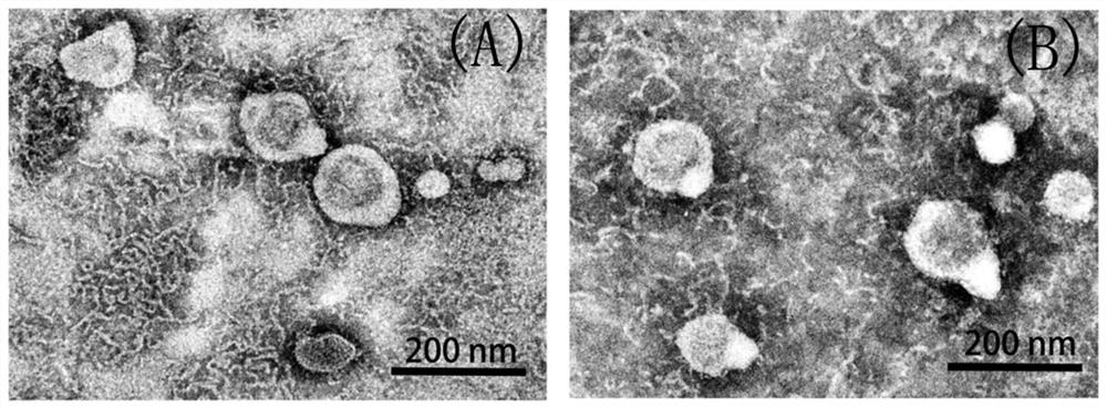 Preparation of an exosome-doxorubicin nano-targeted drug derived from bone marrow mesenchymal stem cells and its anti-osteosarcoma effect in vitro