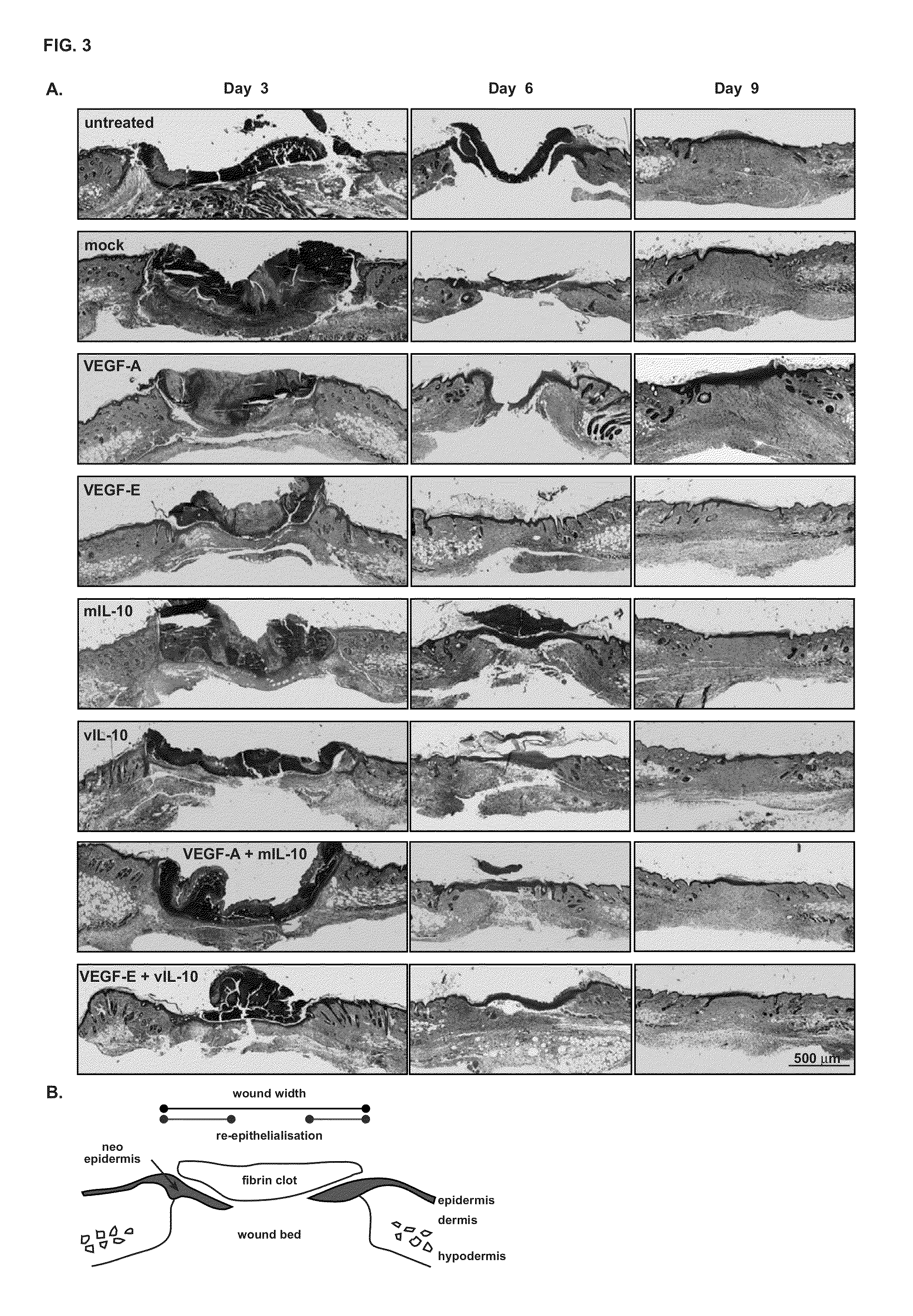 Combination treatments and compositions for wound healing comprising viral VEGF
