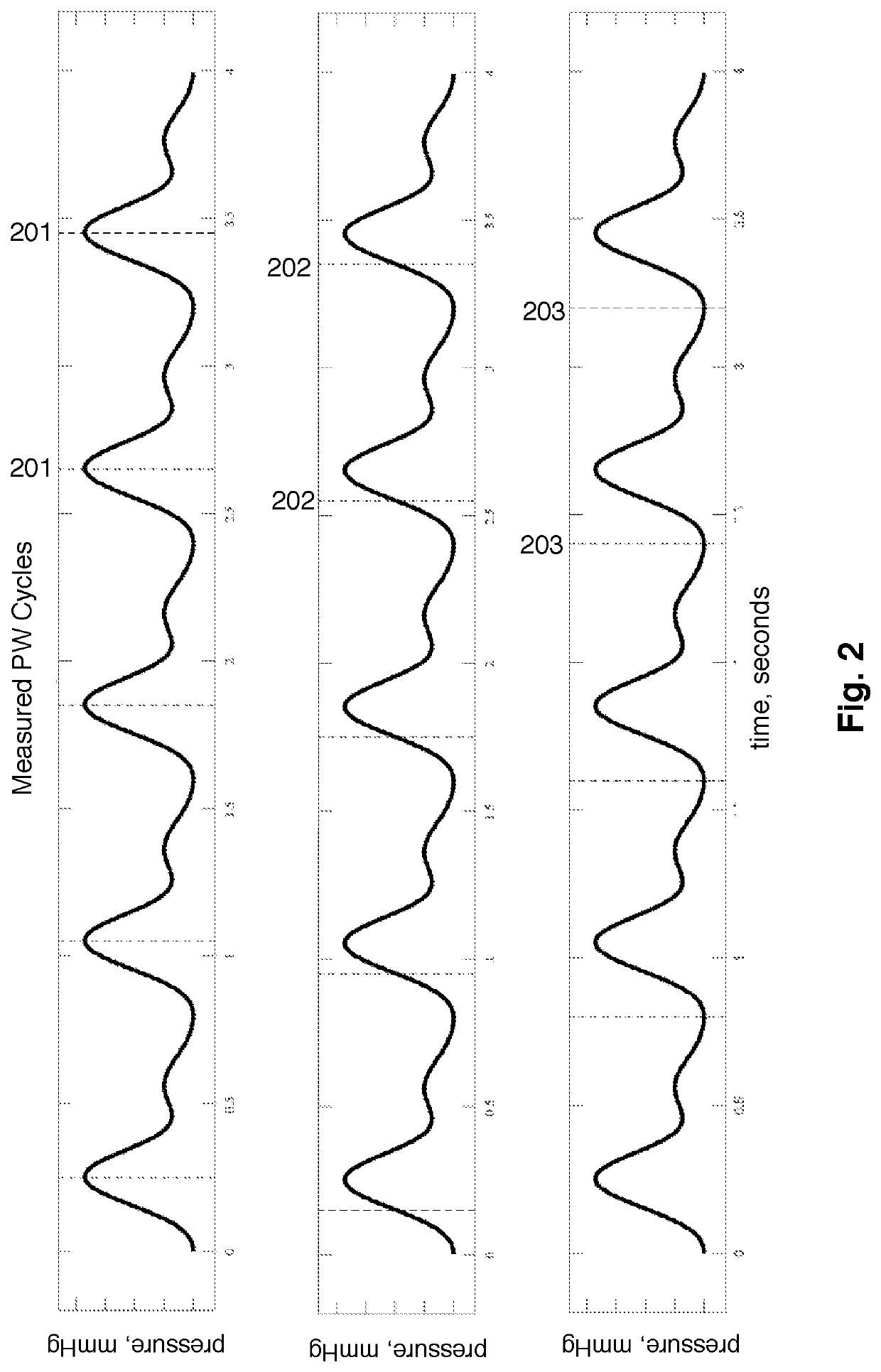 Apparatus, Systems, and Methods for Noninvasive Measurement of Cardiovascular Parameters