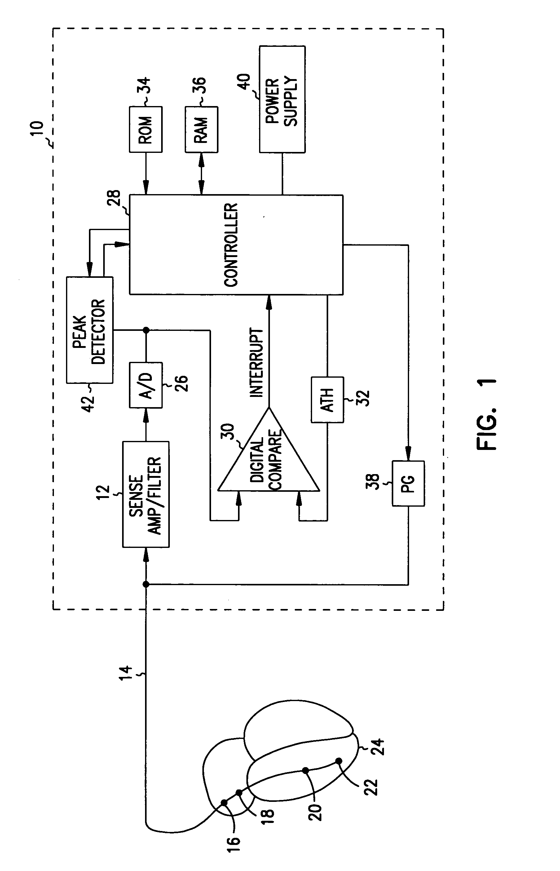 Method and apparatus for adjusting the sensing threshold of a cardiac rhythm management device