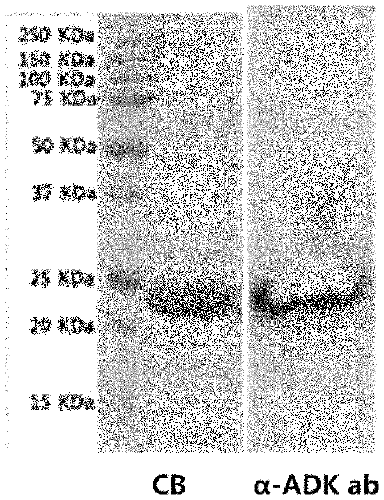 Antibacterial composition for combating carbapenem-resistant gram-negative bacteria comprising ADK protein as active ingredient