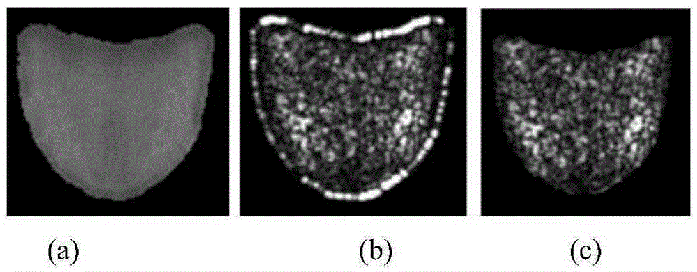 Tongue fur texture identification method based on Gabor wavelet transformation