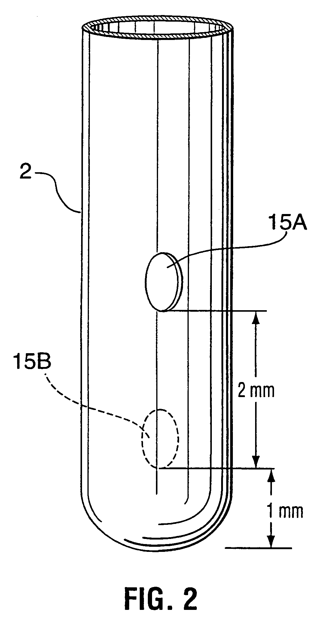 Neural transplantation delivery system