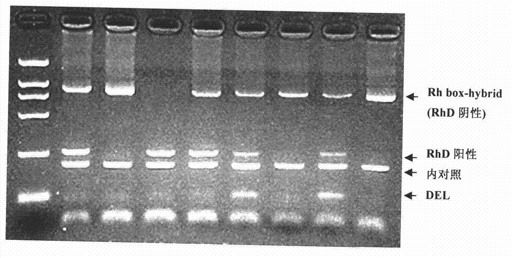 Multiplex polymerase chain reaction (PCR) method and kit for detecting human RhD blood type genotypes