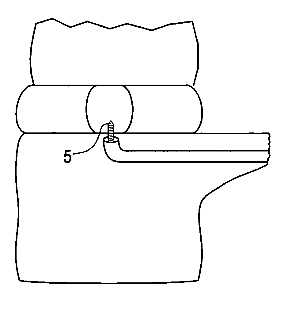 Method and instruments for intervertebral disc augmentation through a pedicular approach