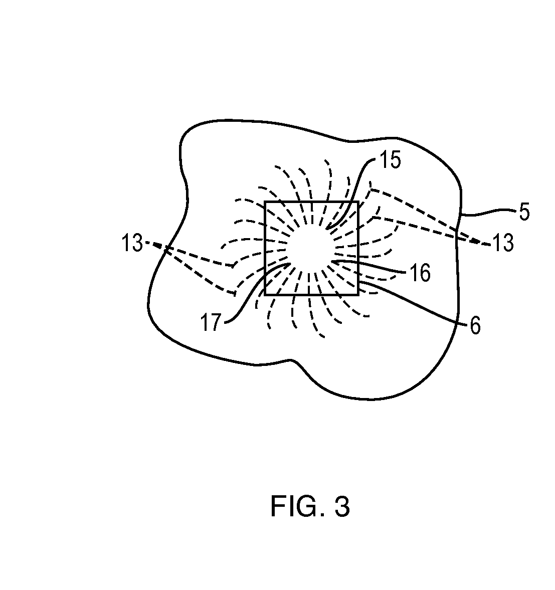 Apparatus and Method for Controlled Fluid Cooling During Laser Based Dental Treatments