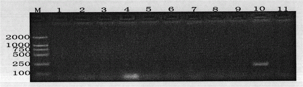 Specific PCR detection method of Riemerella anatipestifer