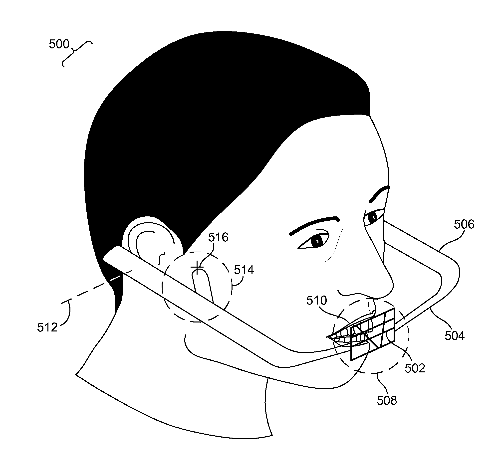 Methods and systems for dental procedures