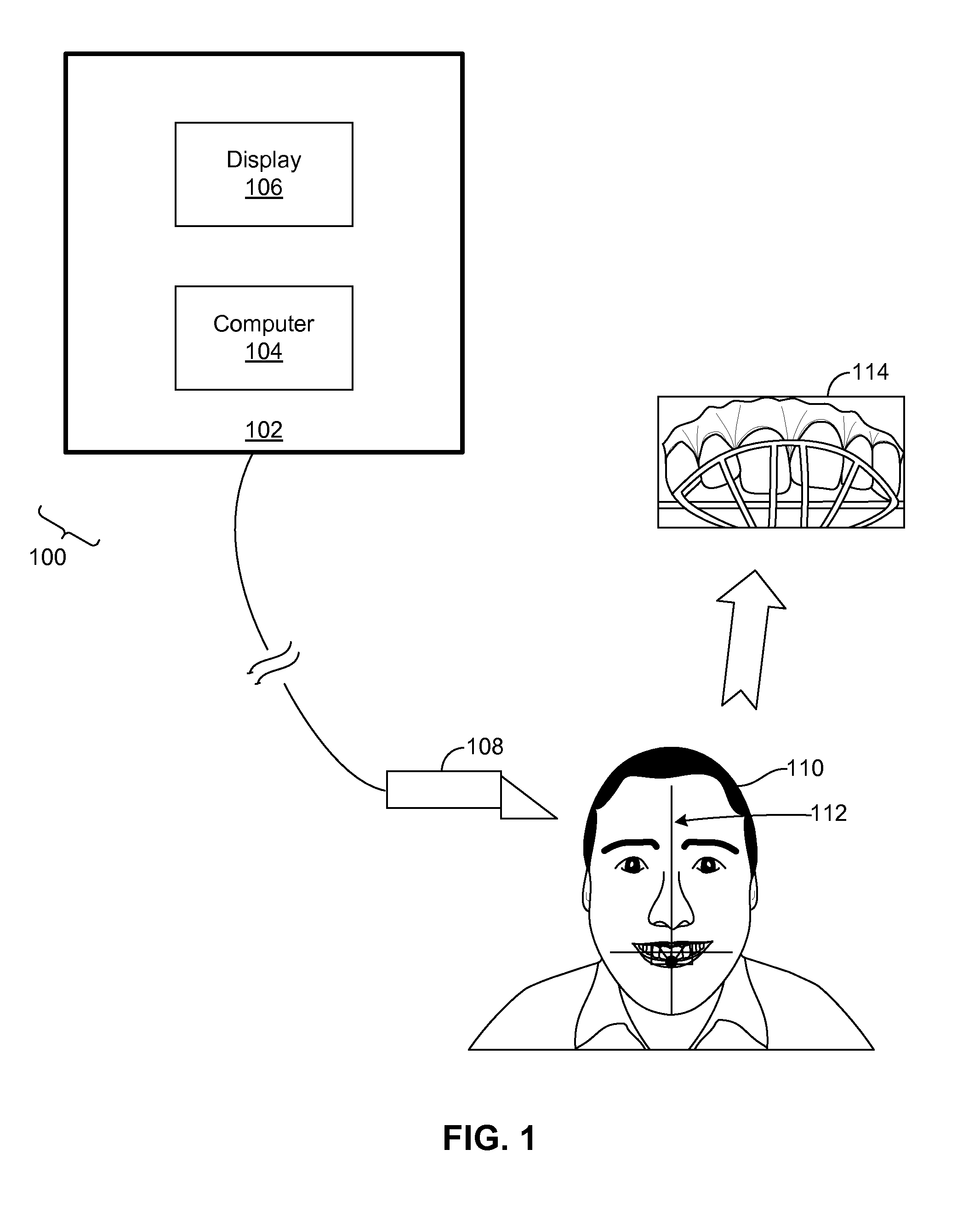 Methods and systems for dental procedures