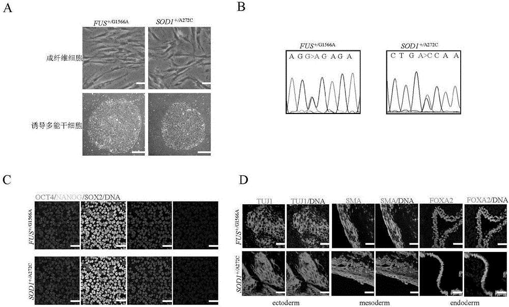 Preparation method of ALS (Amyotrophic Lateral Sclerosis) patient specific motor neuron