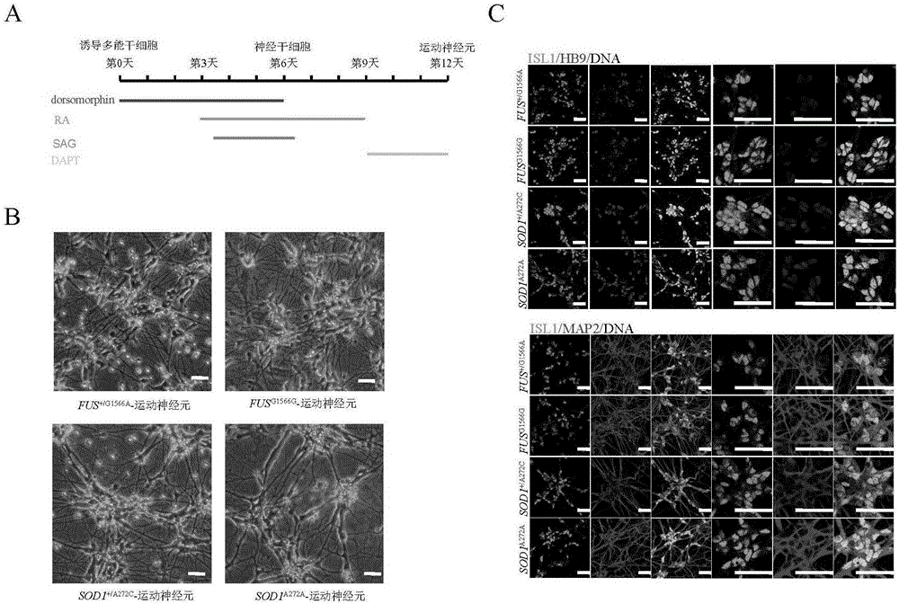 Preparation method of ALS (Amyotrophic Lateral Sclerosis) patient specific motor neuron