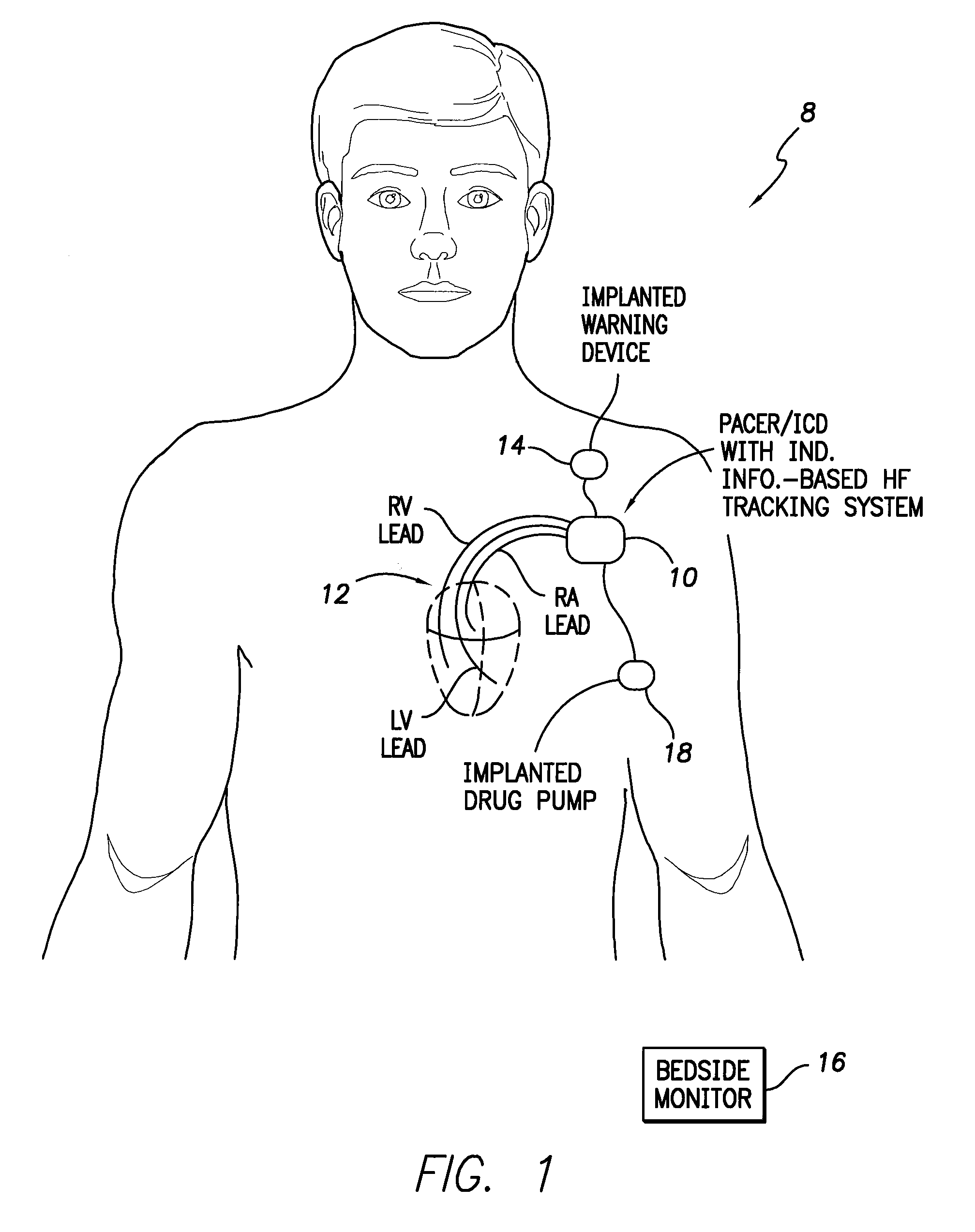 Systems and methods for use by an implantable medical device for detecting heart failure based on the independent information content of immittance vectors