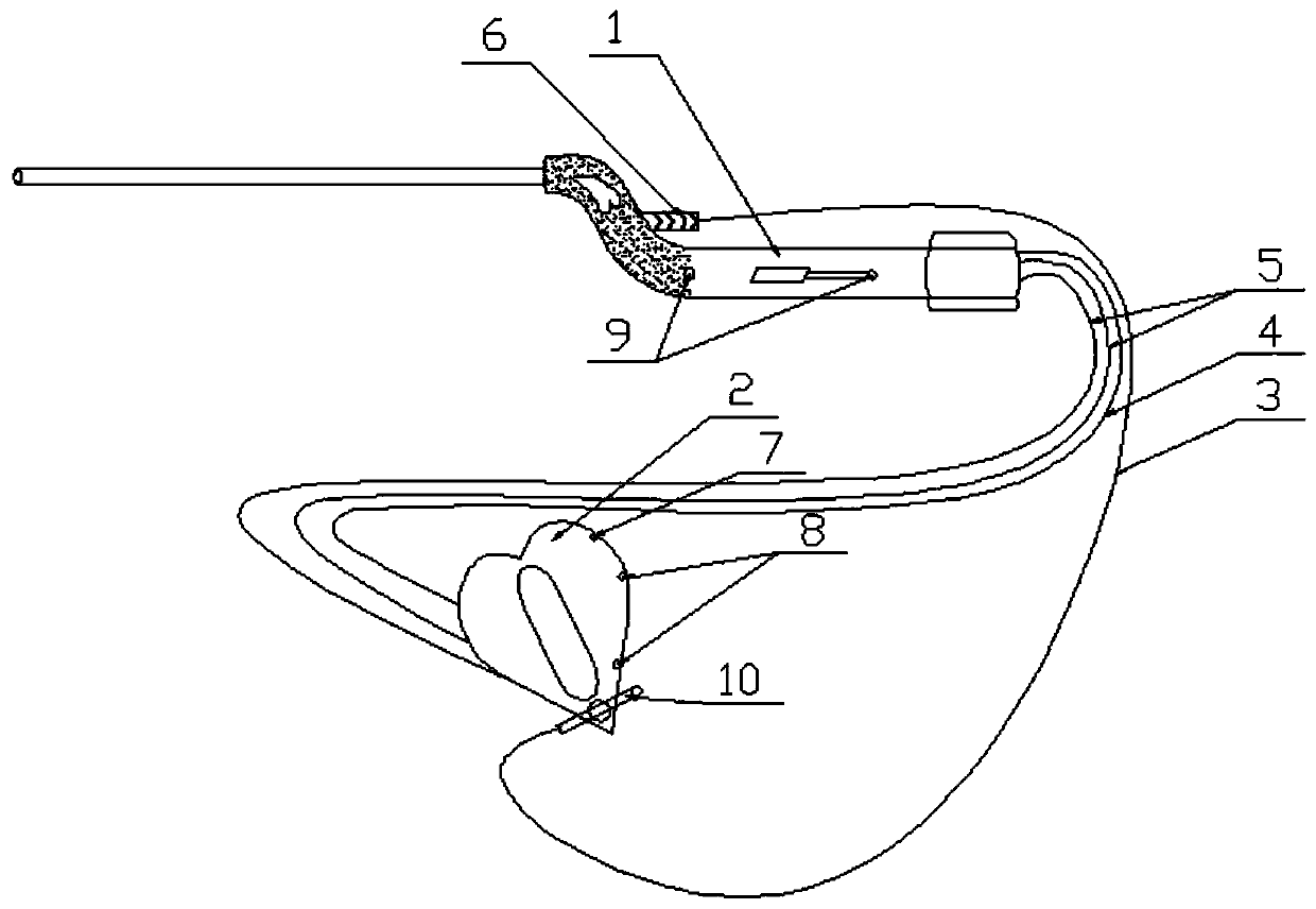 Large-pipeline endoscope integrated instrument