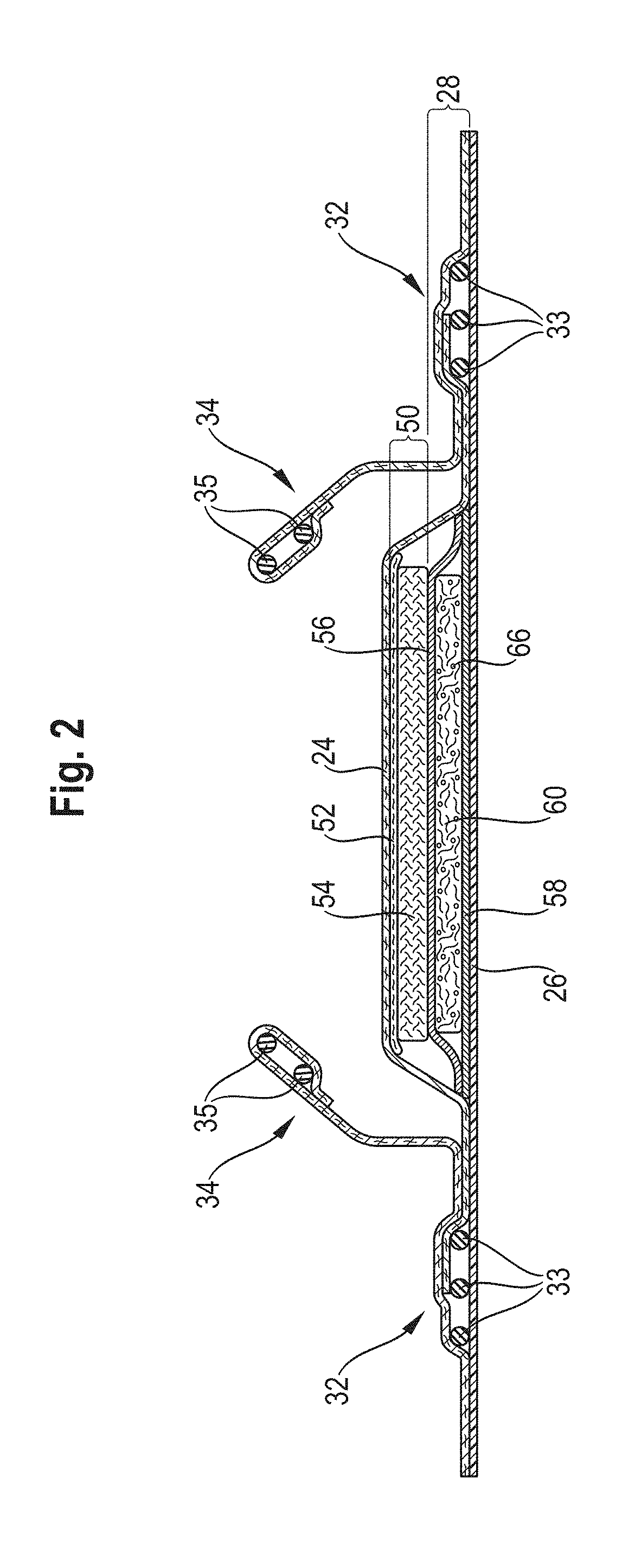 Agglomerated superabsorbent polymer particles comprising clay platelets with edge modification and/or surface modification