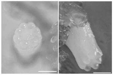 LarixLeptolepis somatic embryo regeneration method