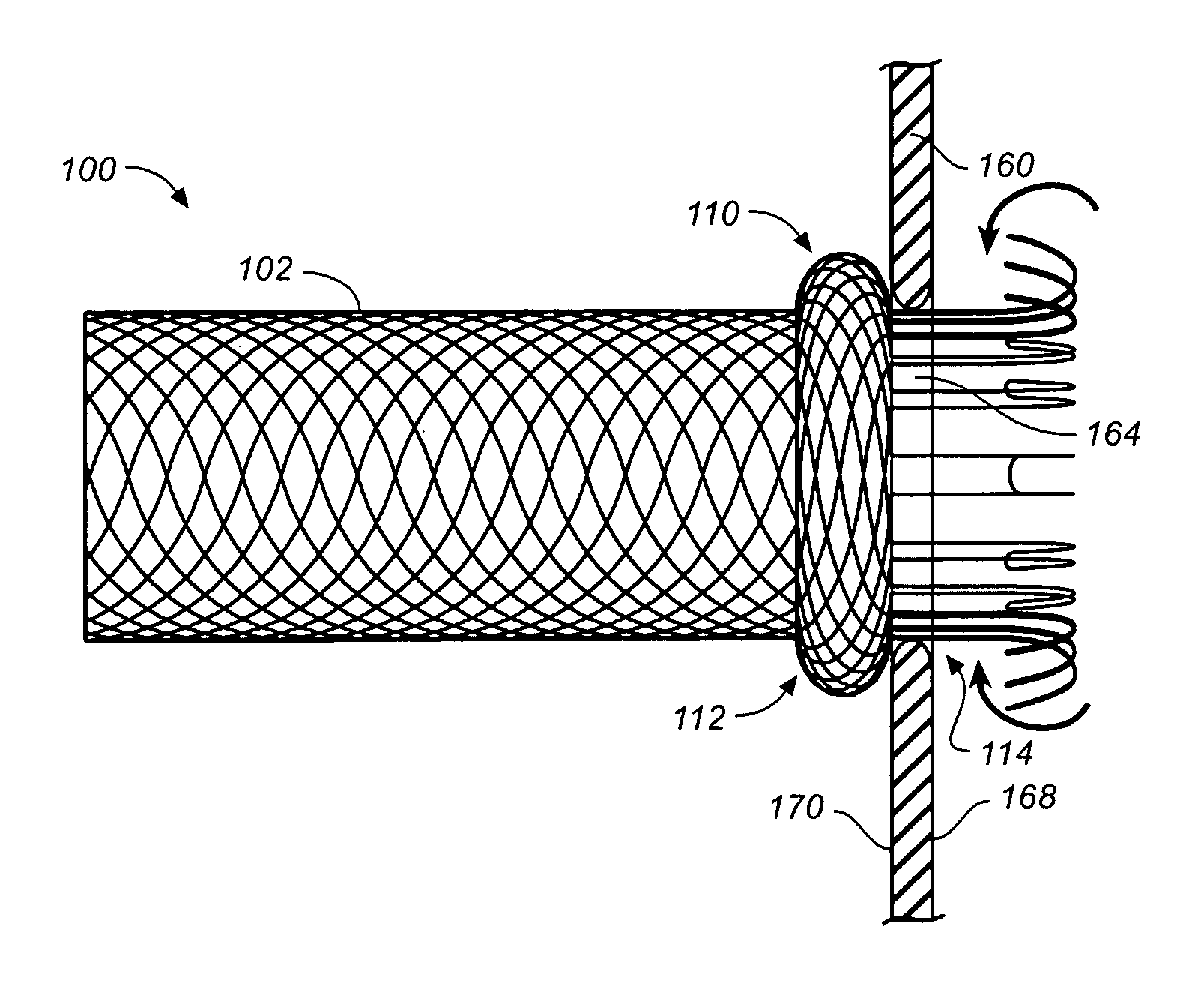 Branch vessel prosthesis with a roll-up sealing assembly