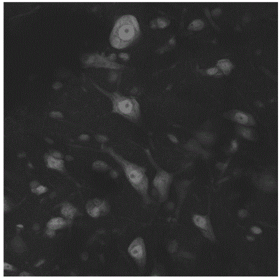 Application of miRNA-219 compound in the preparation of chronic pain diagnostic markers and therapeutic drugs