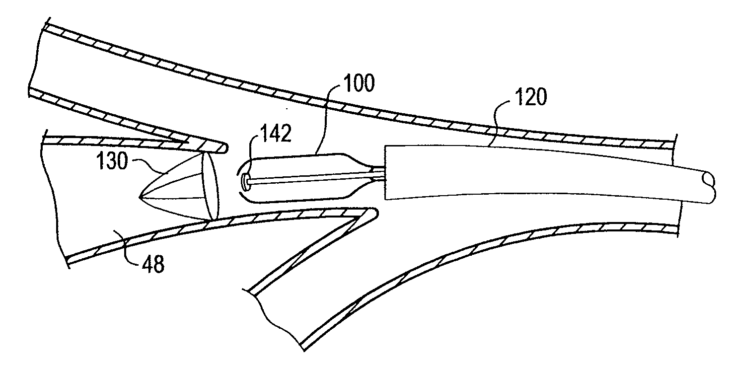 Apparatus and method for deployment of a bronchial obstruction device