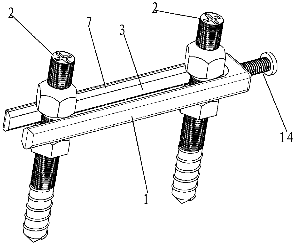 External mandibular fracture fixator and fixing method thereof