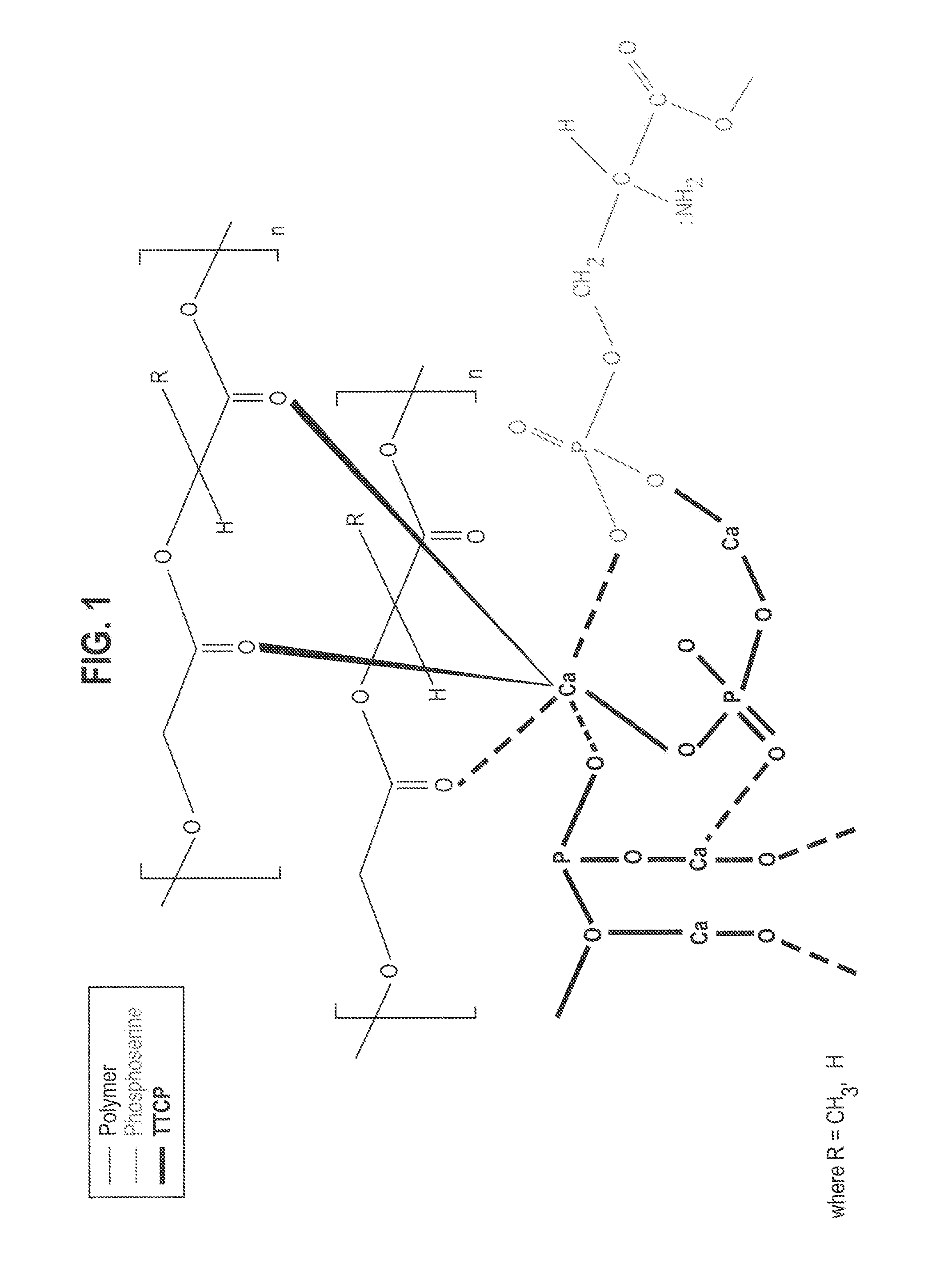 Organophosphorous, Multivalent Metal Compounds, & Polymer Adhesive Interpenetrating Network Compositions & Methods