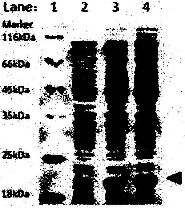 A kind of preparation method of gpx7 recombinant protein