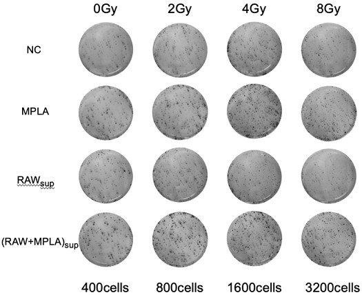 Application of TLR4 excited exosome or exosome preparation in preparation of medicine for preventing and treating radiation-induced lung injury