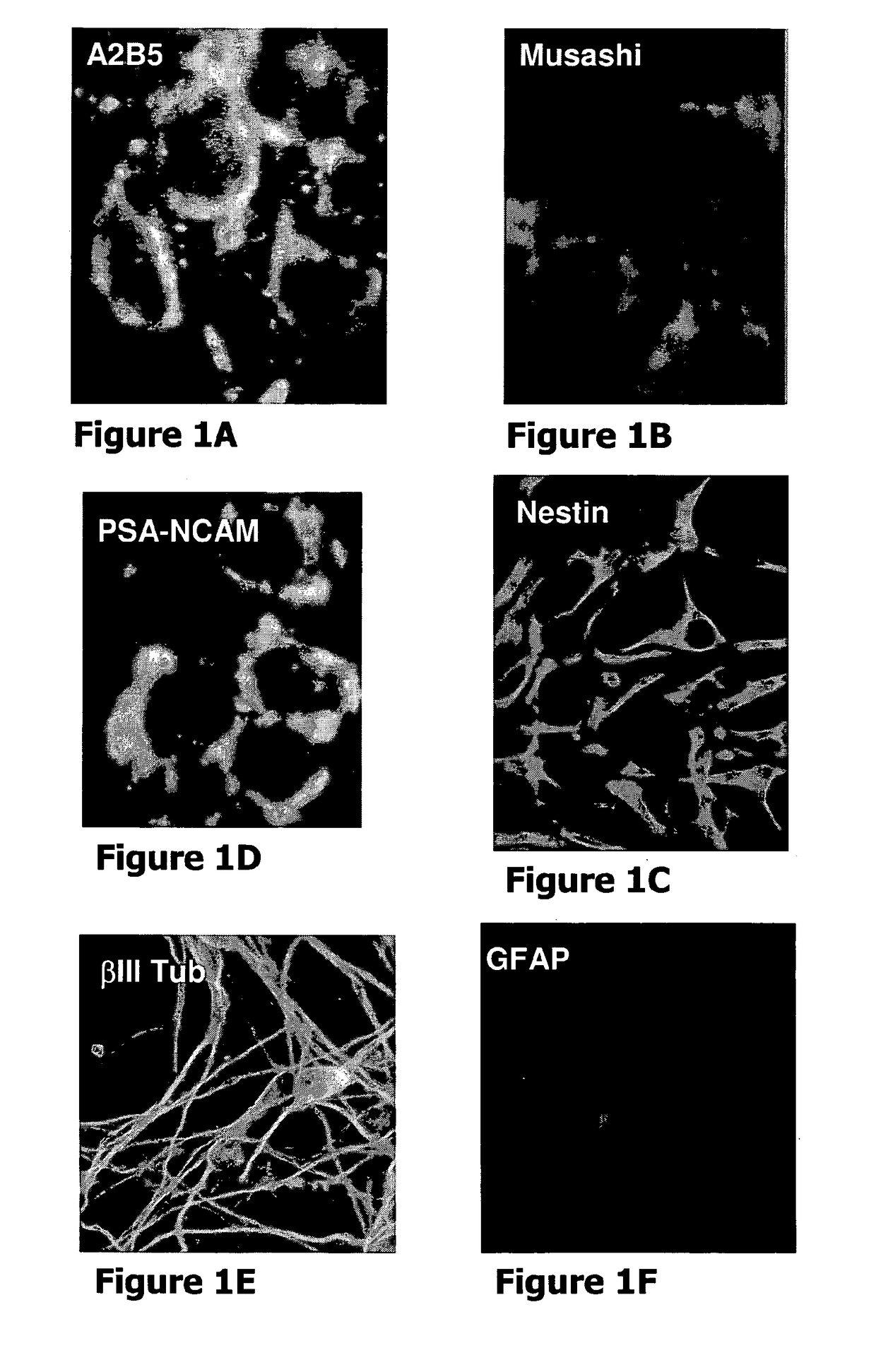Human stem cell-derived neural precursors for treatment of autoimmune diseases of the central nervous system