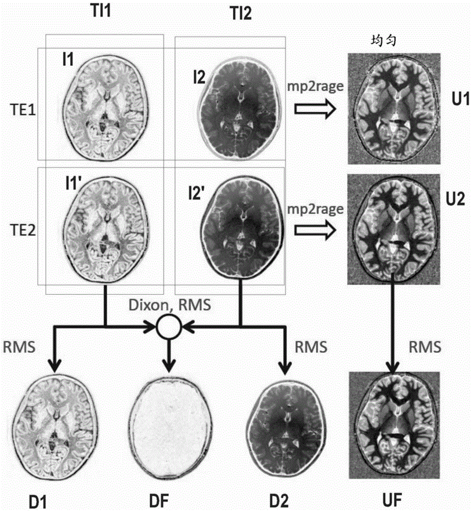 Atlas-free brain tissue segmentation method